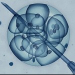 Einer Eizelle wird mit einer Pinzette Spermium injiziert.