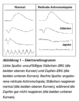 Kurven eines Elektroretinogramms